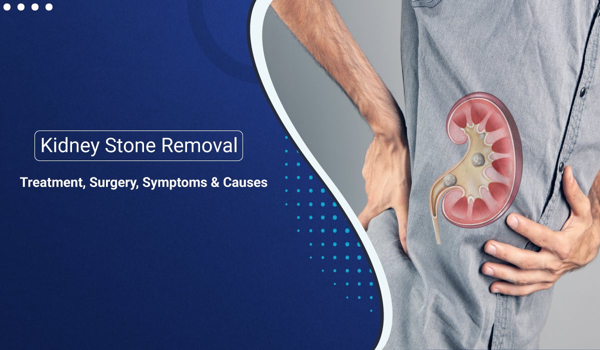 Post Op Care After Kidney Stone Removal