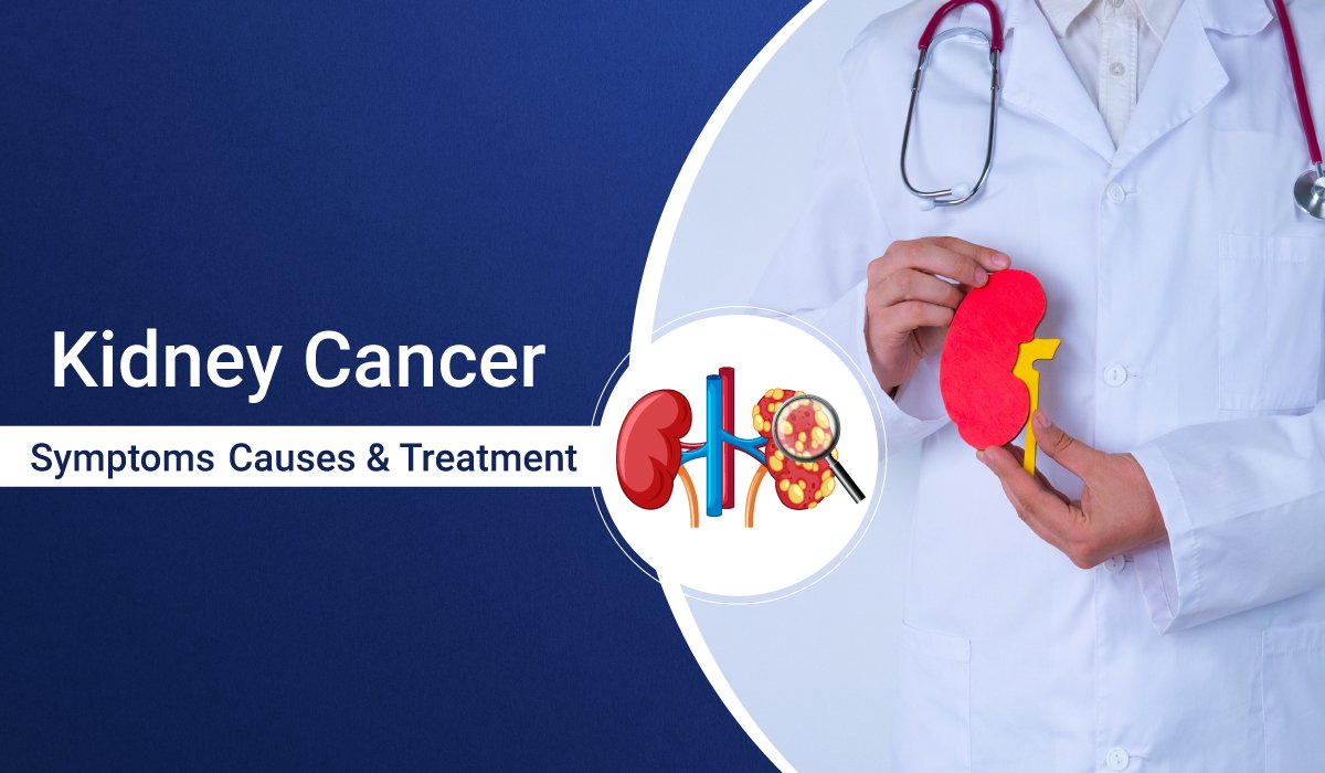 Kidney Cancer: Symptoms, Causes & Treatment