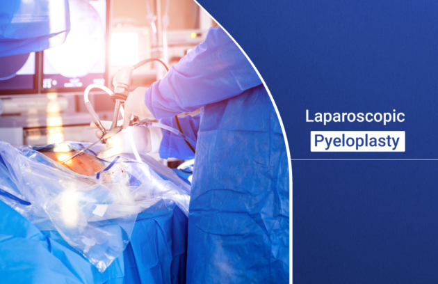 pyeloplasty laparoscopic