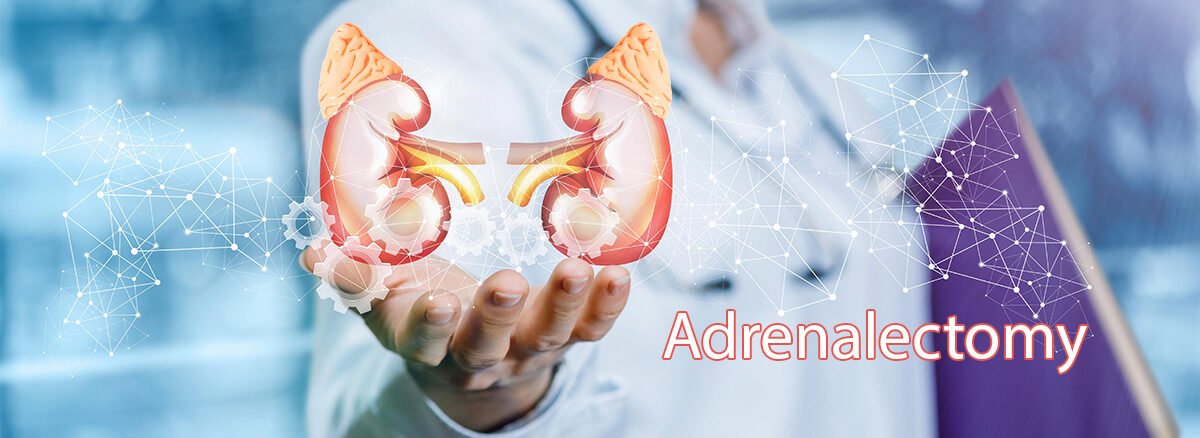 Adrenalectomy(Adrenal Gland)