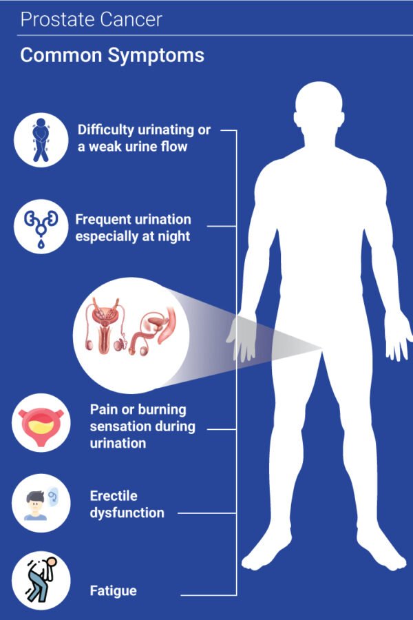 Prostate Cancer: Causes, Symptoms, and Treatment