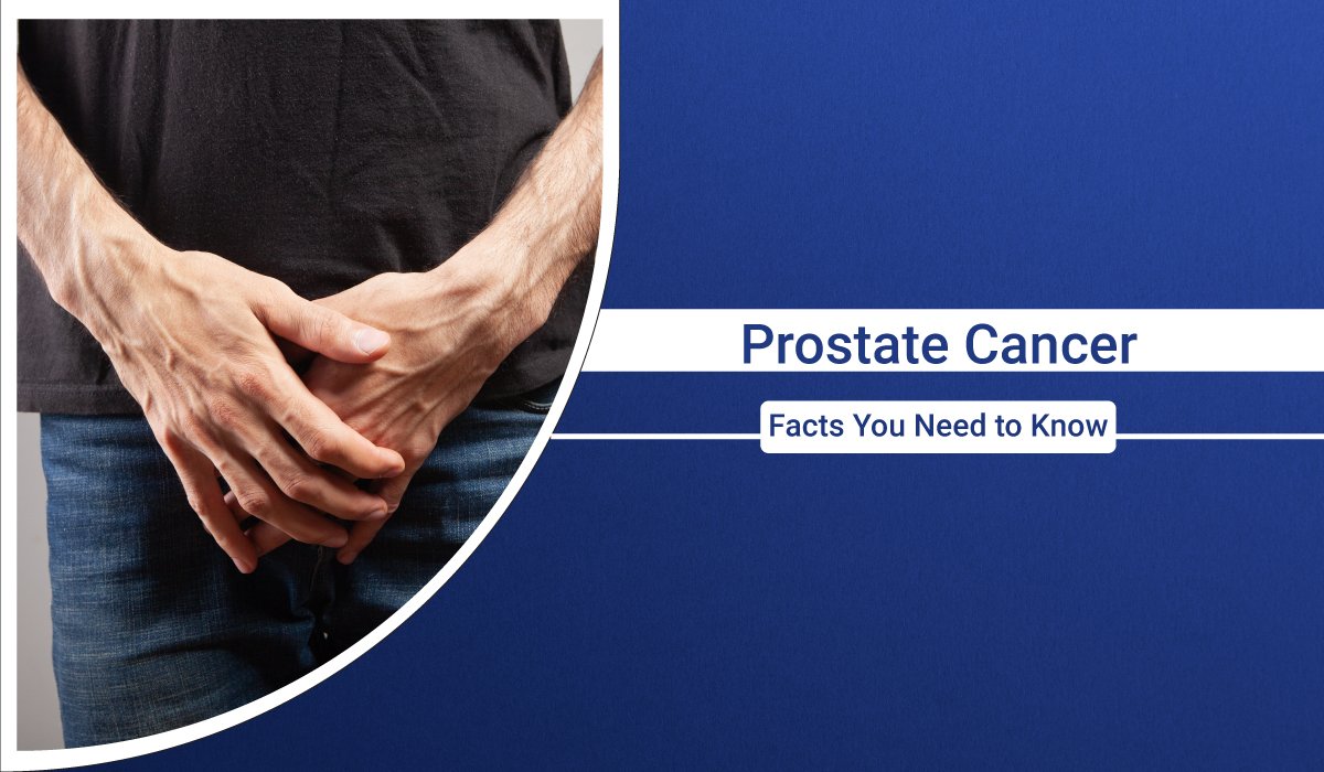 Prostate Cancer Understanding The Basics And Facts You Need To Know 2869