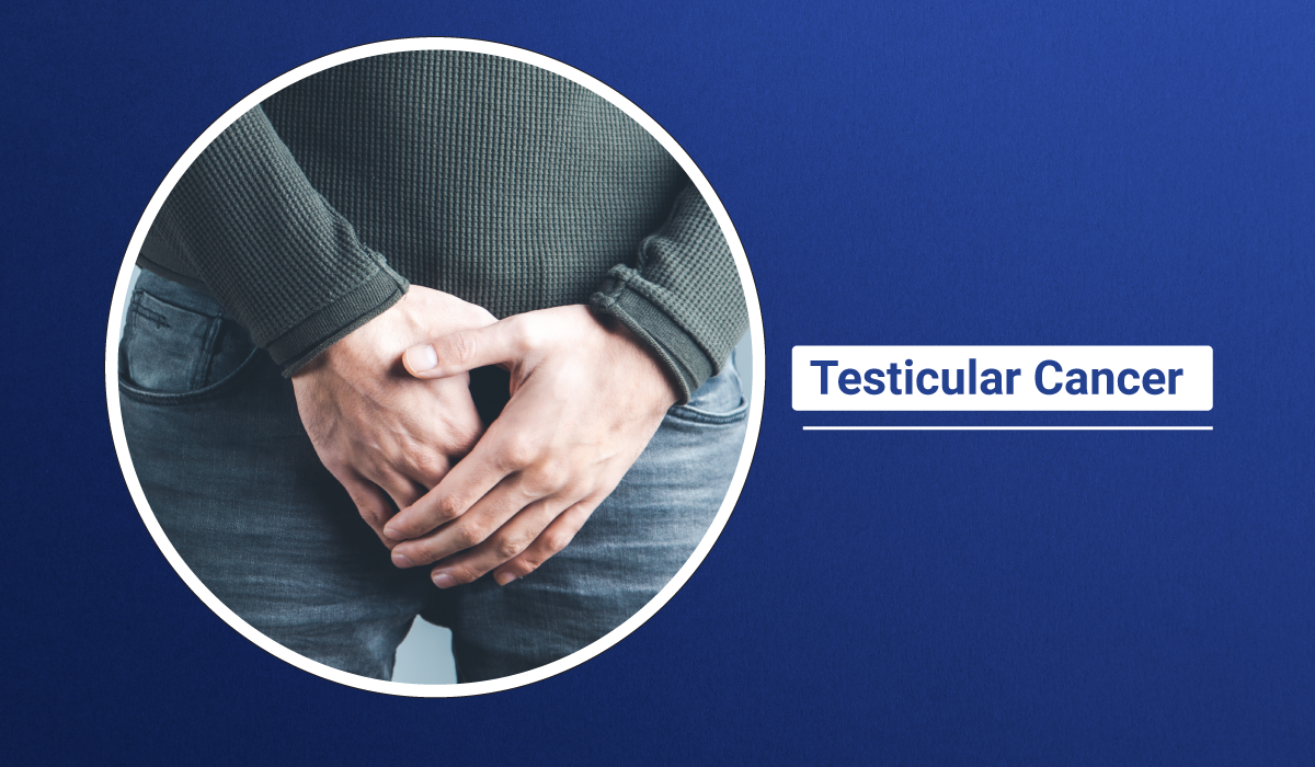 What Is Testicular Cancer Types Of Testicular Cancer 