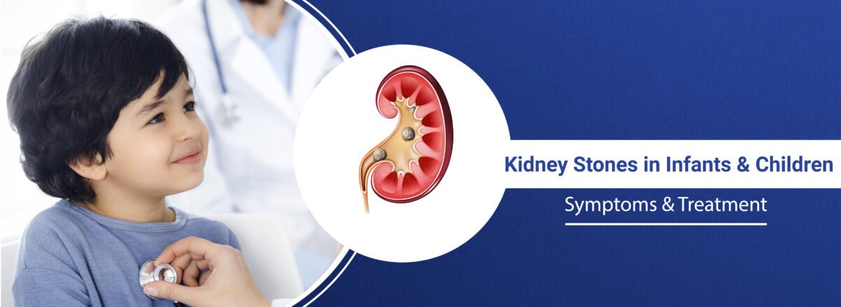 Kidney Stone In Infant and Children