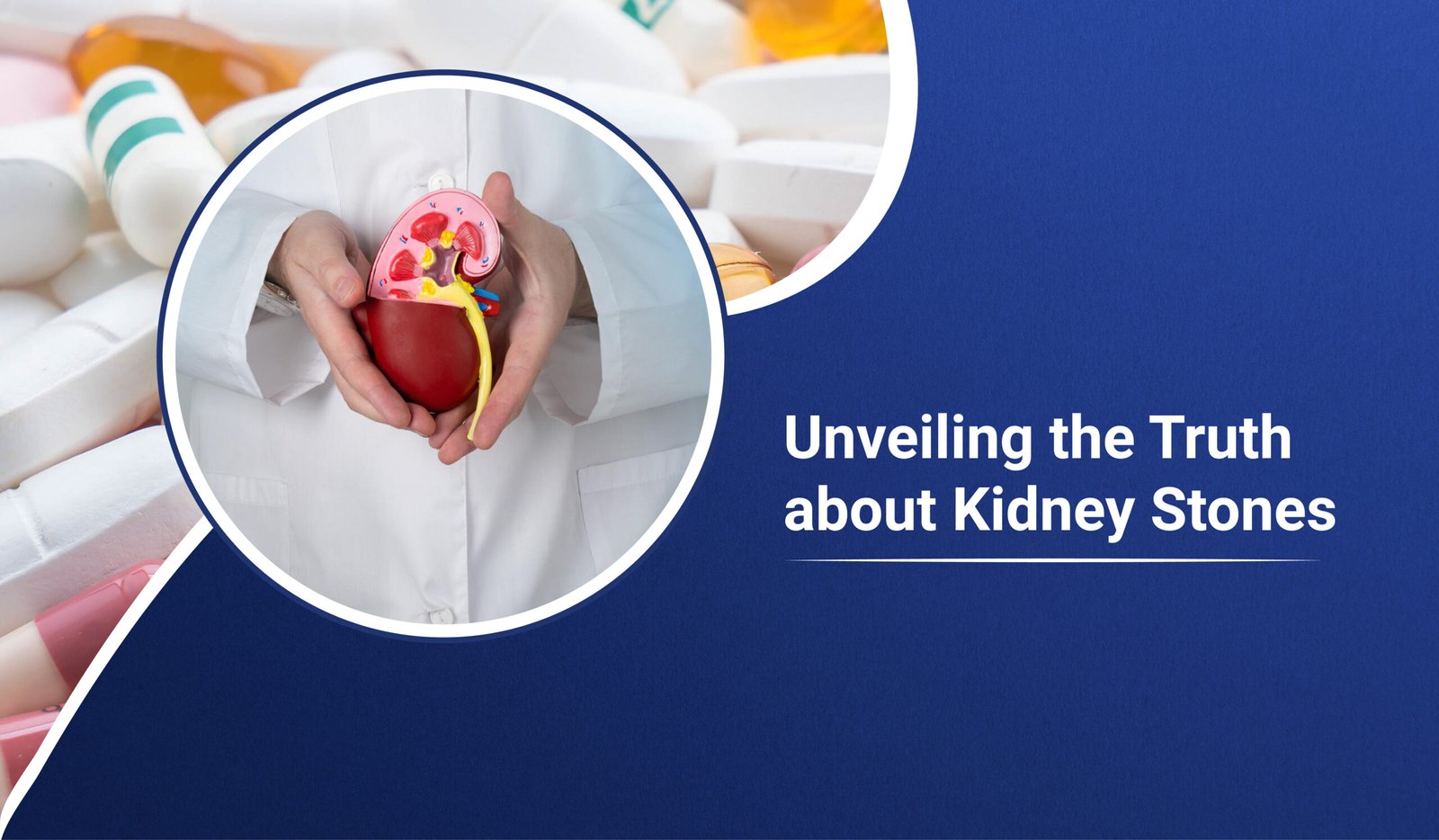 Truth about Kidney Stones