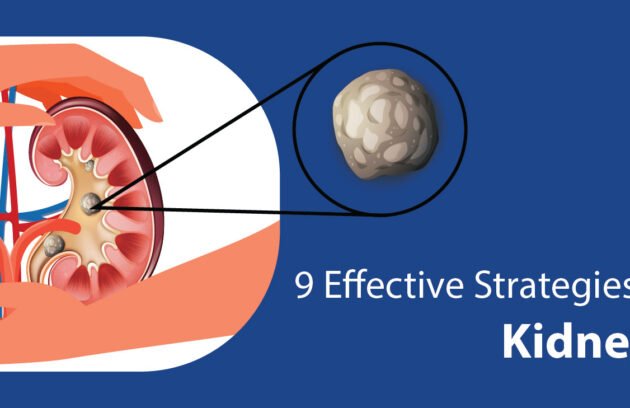 Effective Strategies to Prevent Kidney Stones