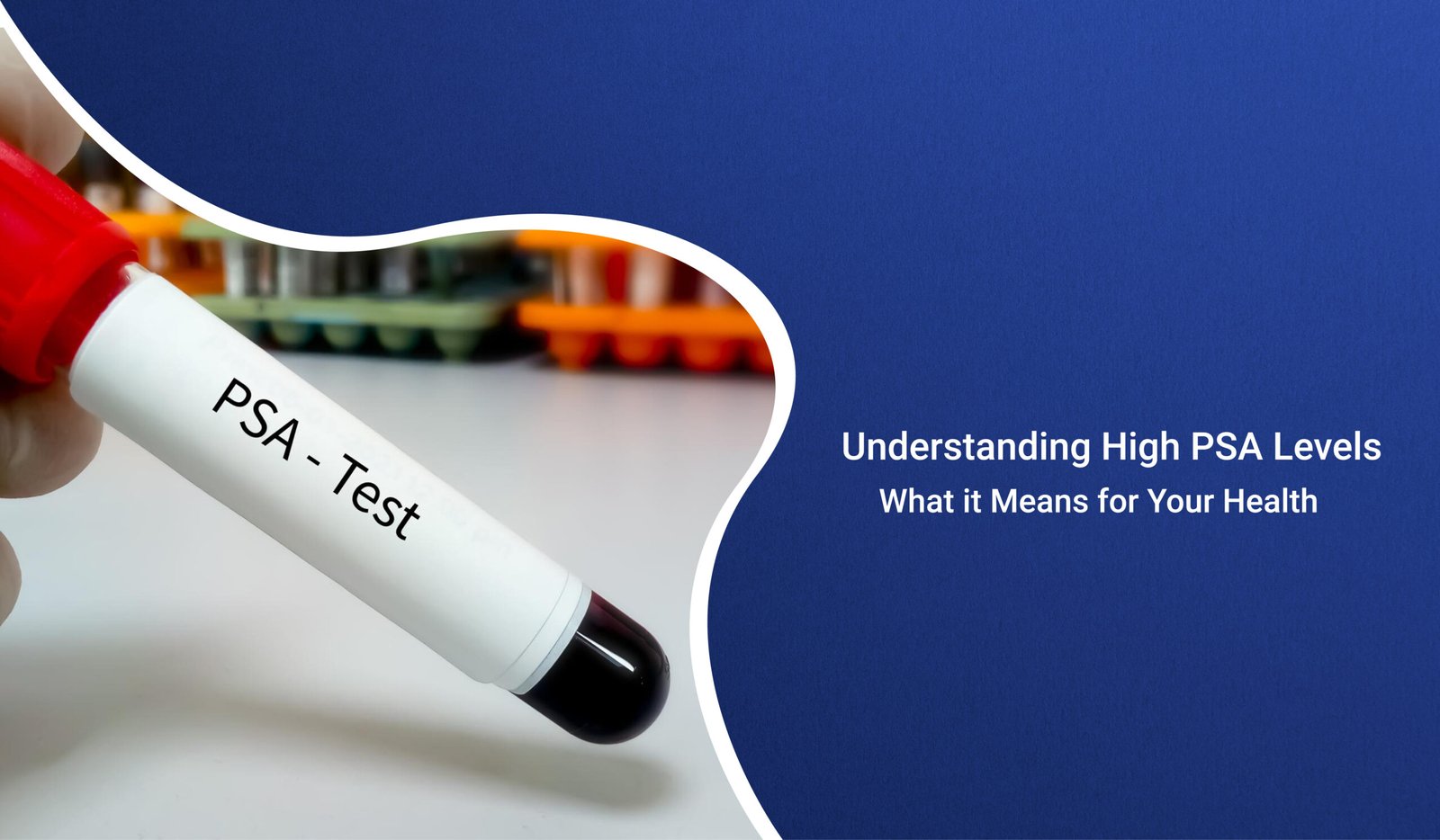 prostate-specific antigen