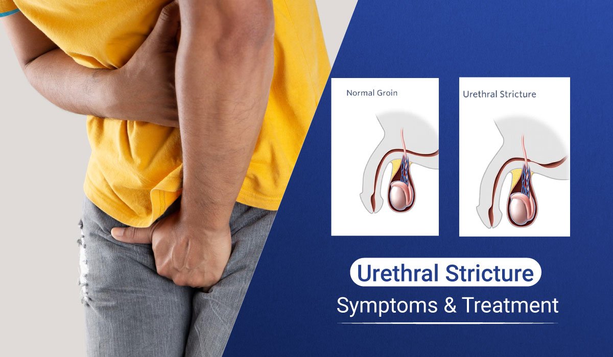 Treatment of urethral stricture disease in women