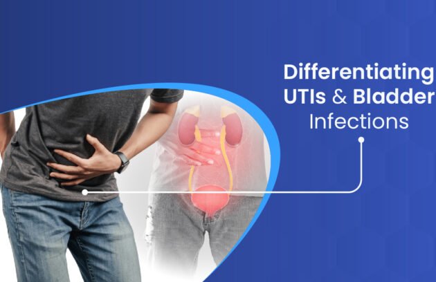 Differentiating UTIs and Bladder Infections