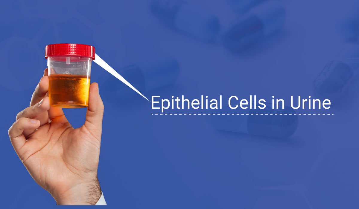 What Epithelial Cells In Urine Can Tell You 3603