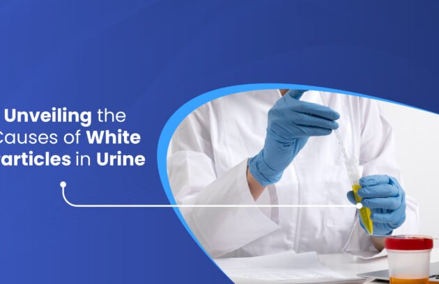 White Particles in Urine and Their Causes