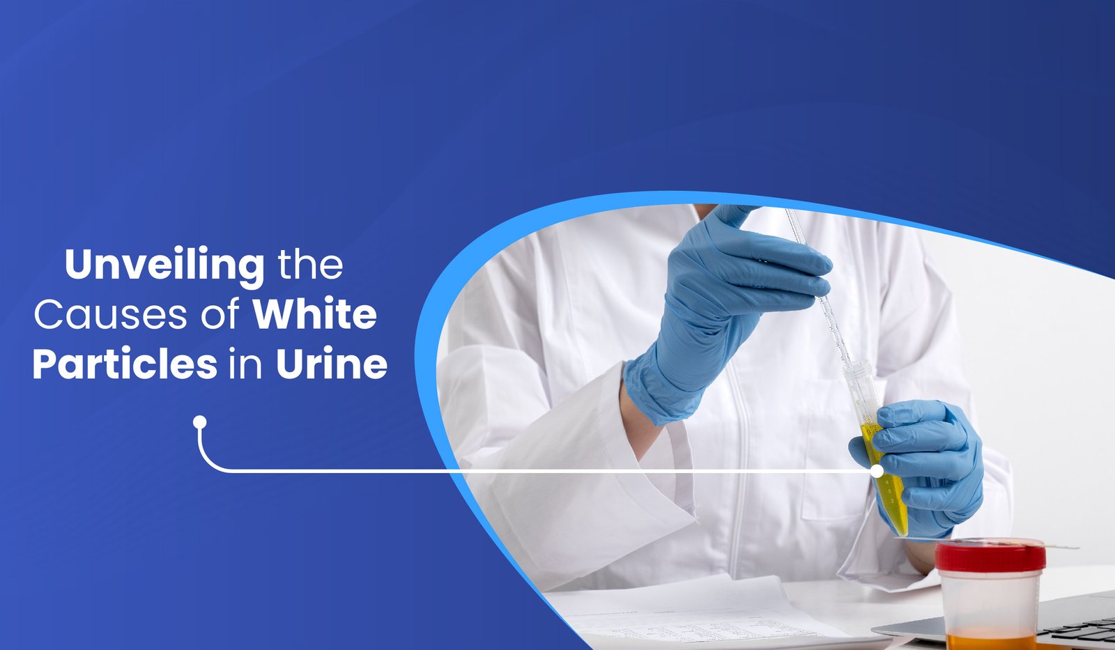 White Particles in Urine and Their Causes