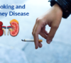 Smoking and Kidney Disease