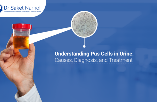 Understanding Pus Cells in Urine