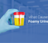 What Causes Foamy Urine