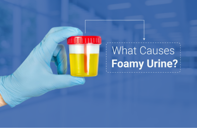 What Causes Foamy Urine