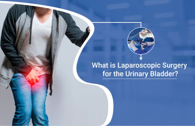 Laparoscopic Surgery for the Urinary Bladder