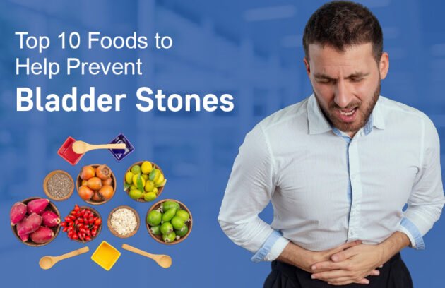 Foods for Prevent Bladder Stones