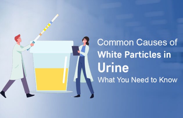 white particle in urine