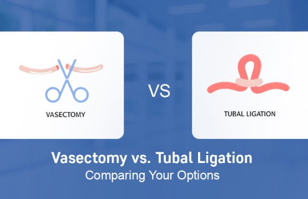 Vasectomy vs Tubal Ligation