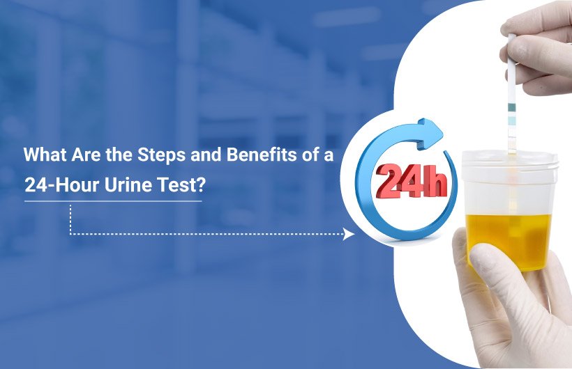 24-Hour Urine Test in Dhanbad