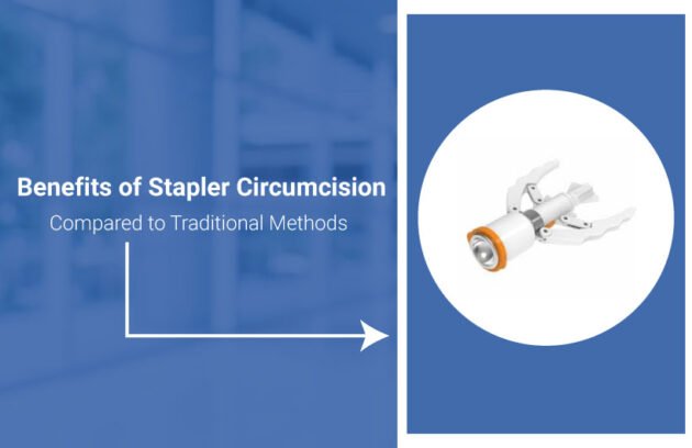 Benefits of Stapler Circumcision