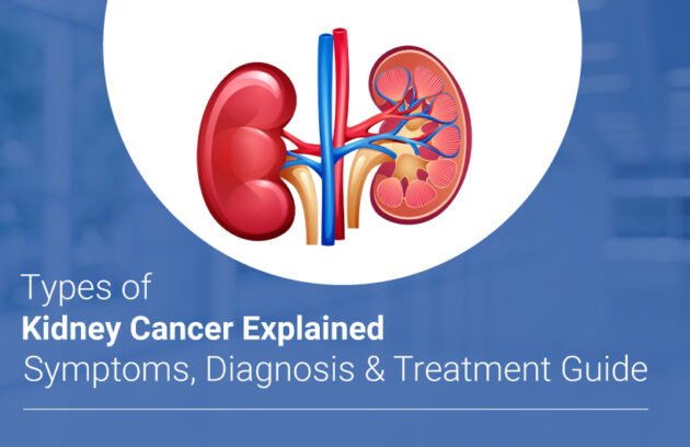 kidney cancer symptoms & treatment in Dhanbad