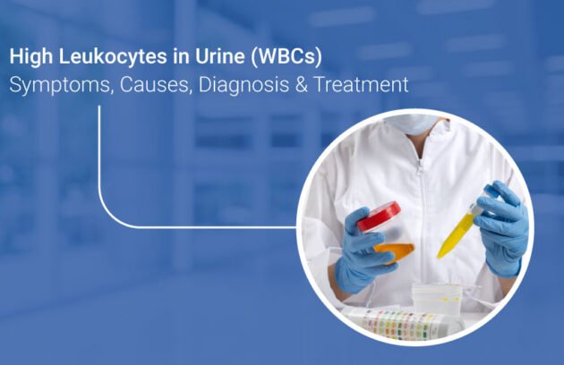 White blood cells in urine causes and treatment