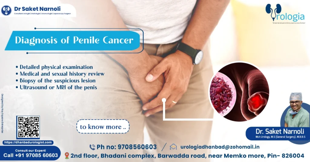 Diagnosis of Penile Cancer