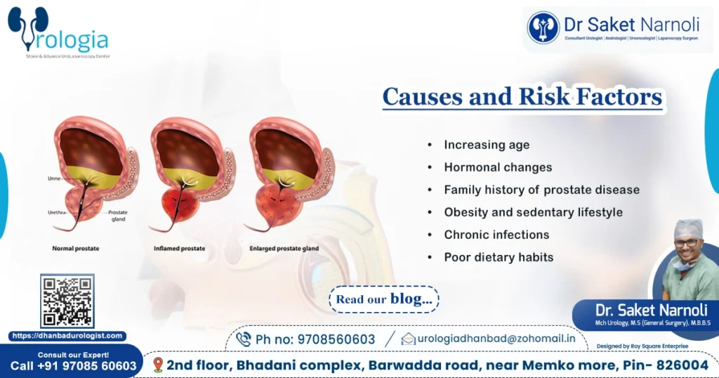 Causes and Risk Factors