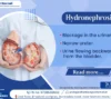 Hydronephrosis