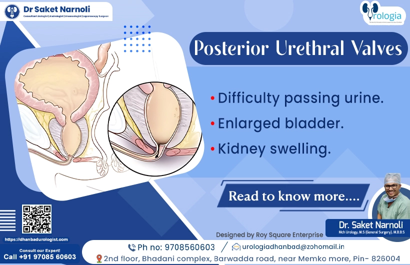 Posterior Urethral Valves