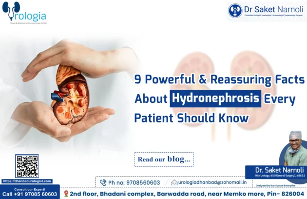 Hydronephrosis