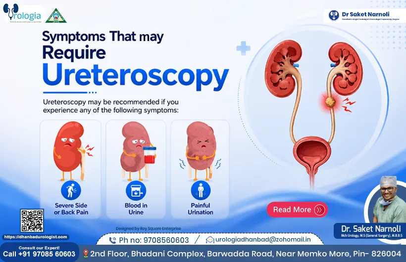 Symptoms That May Require Ureteroscopy