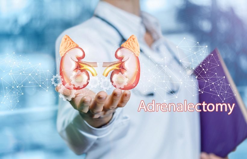 Adrenalectomy(Adrenal Gland)