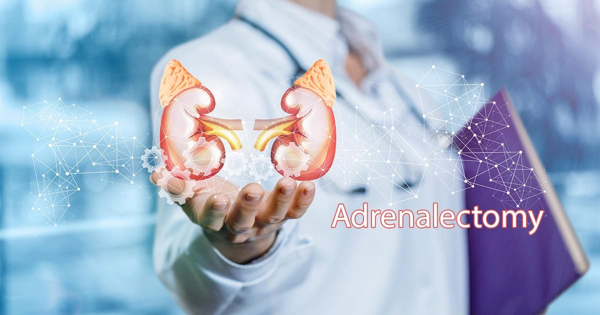 Adrenalectomy(Adrenal Gland)