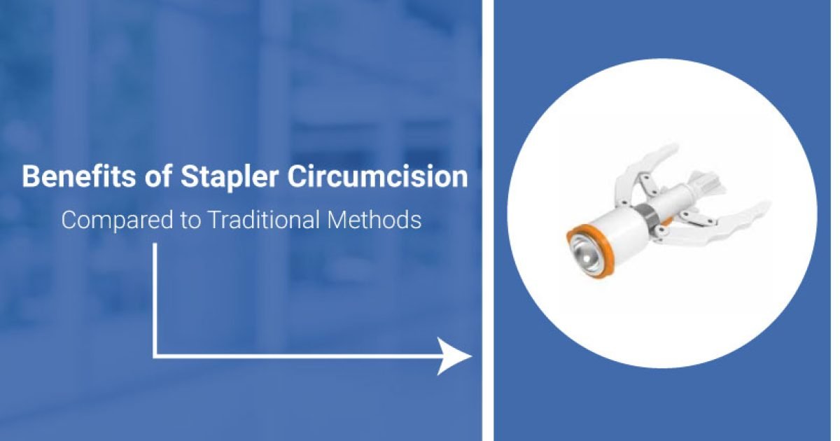 Benefits of Stapler Circumcision