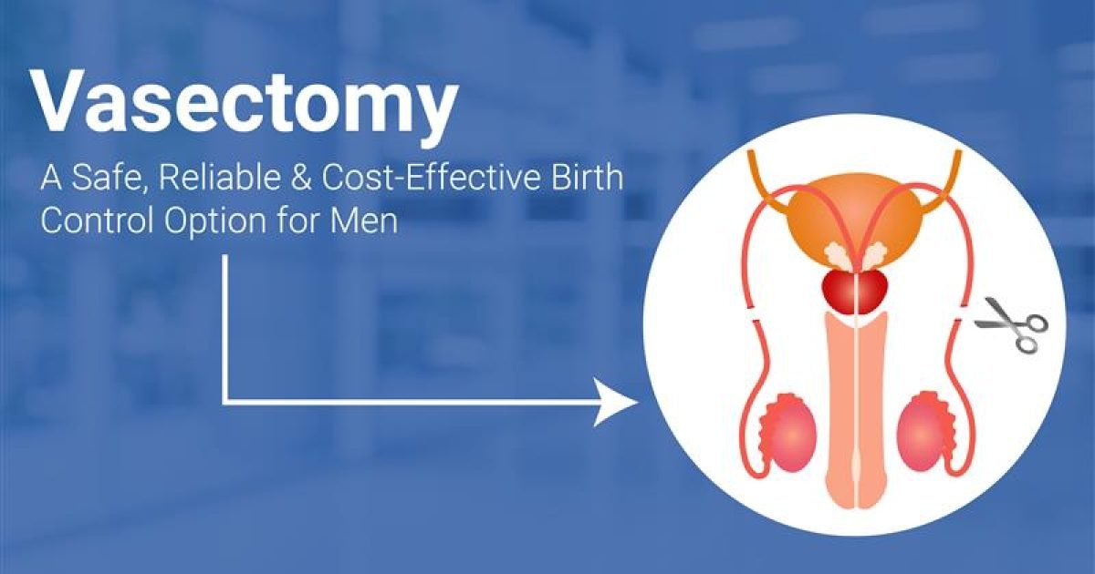 Benefits of Vasectomy Treatment