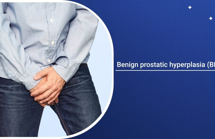 Benign prostatic hyperplasia (BPH)