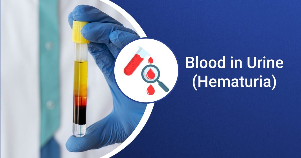 Blood in Urine (Hematuria)