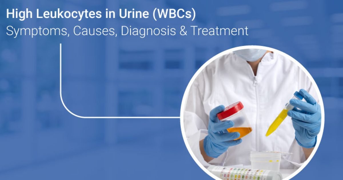White blood cells in urine causes and treatment