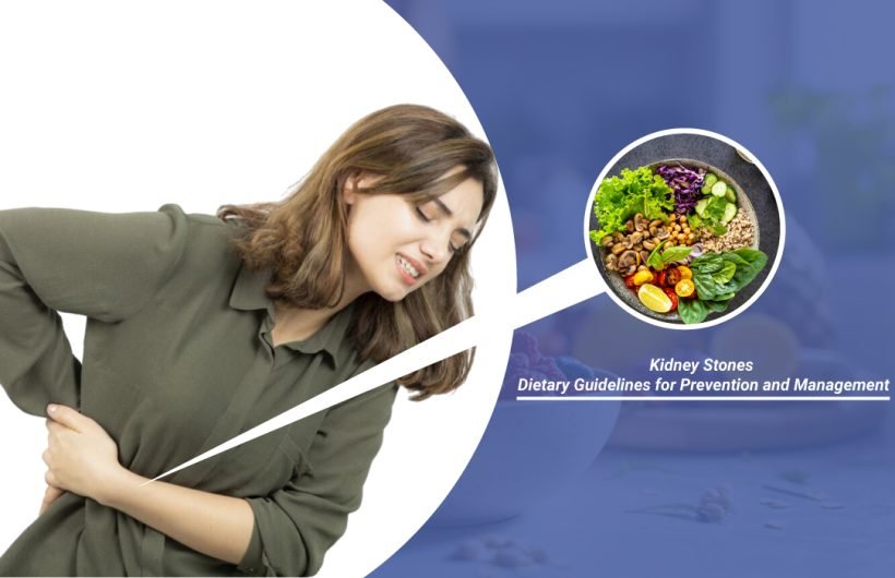 Kidney Stones Dietary Guidelines for Prevention