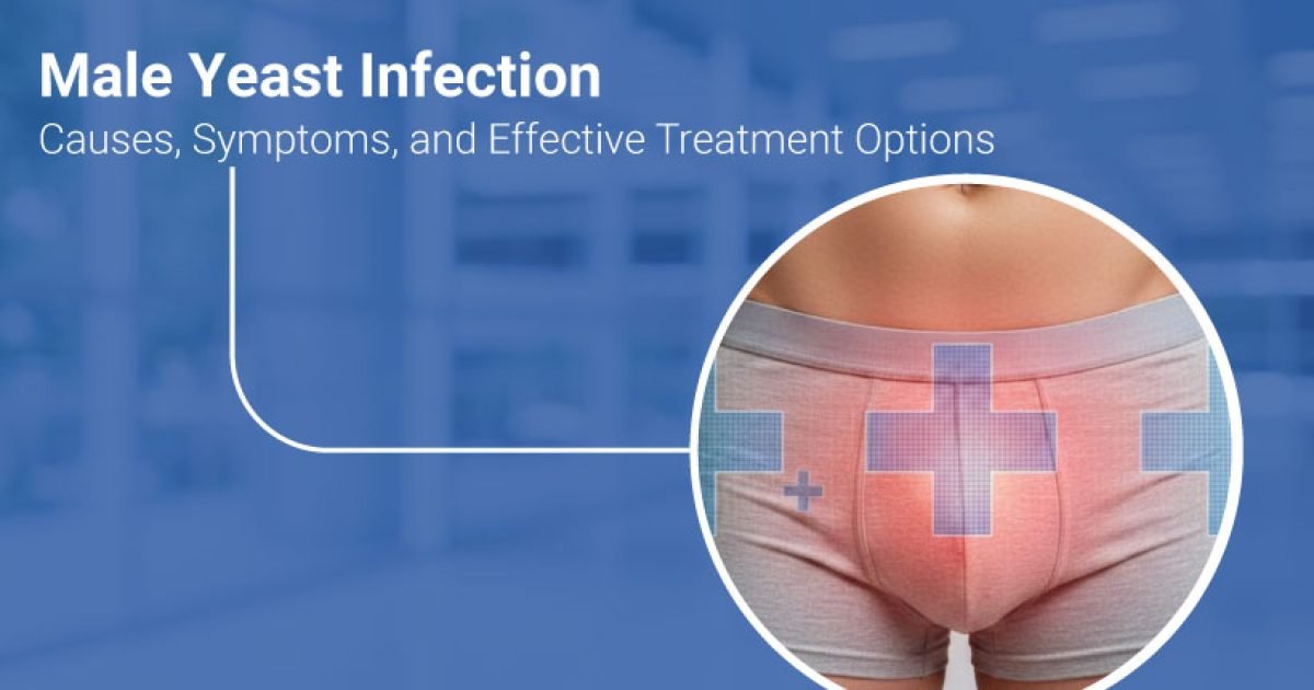 Male yeast infection symptoms and causes
