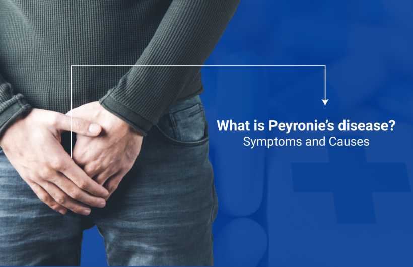 Peyronie’s disease