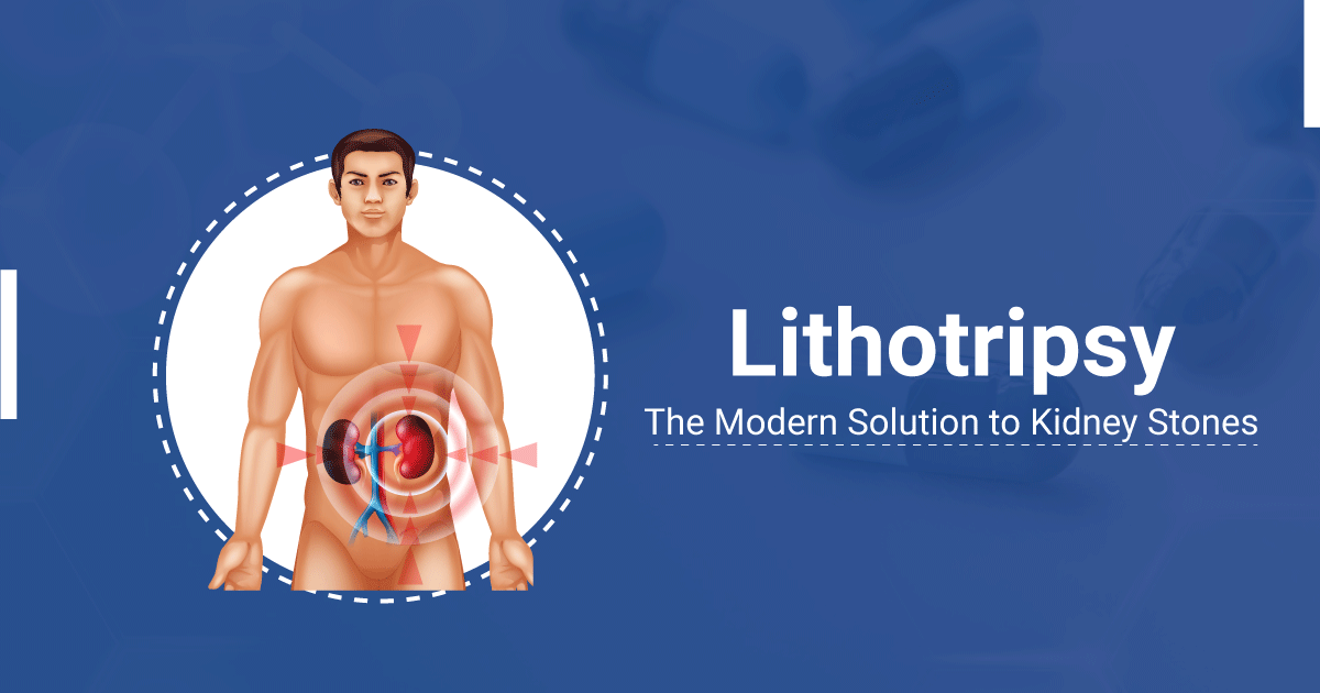 Shock Wave Lithotripsy - Kidney Stone Treatment