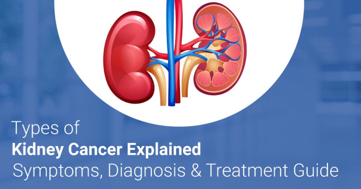 kidney cancer symptoms & treatment in Dhanbad