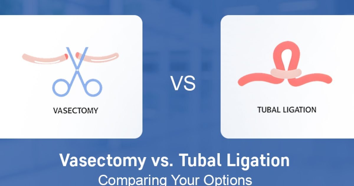 Vasectomy vs Tubal Ligation