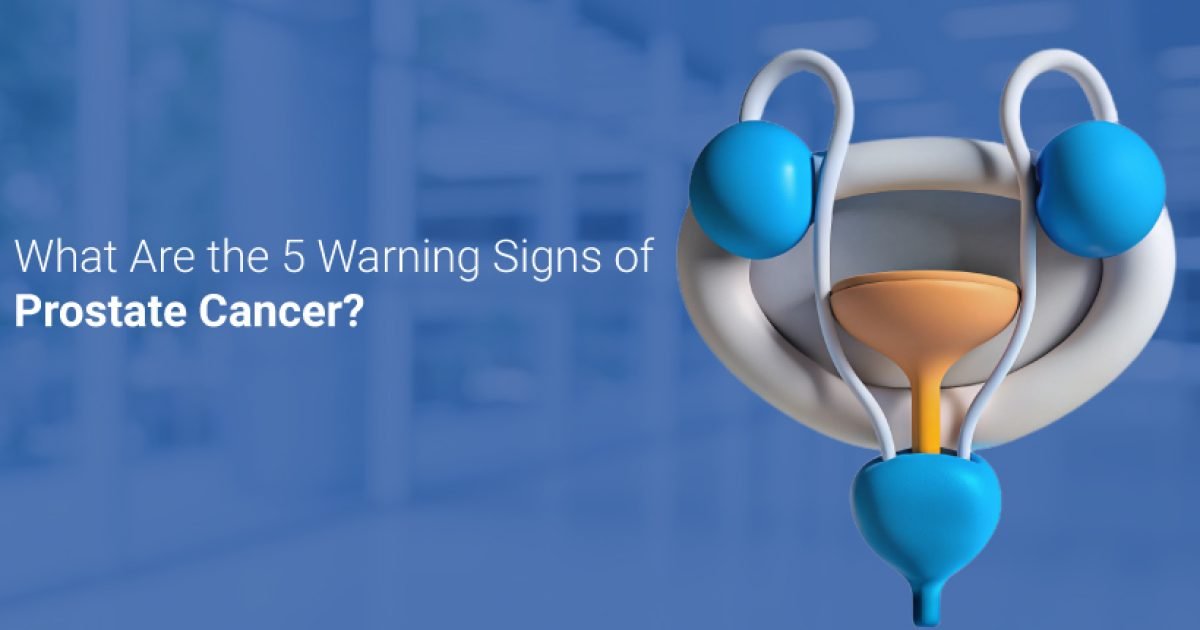 Top signs of prostate cancer