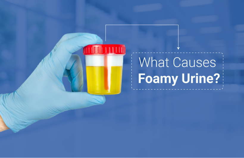 What is Foamy Urine? Causes, Symptoms, and Treatment