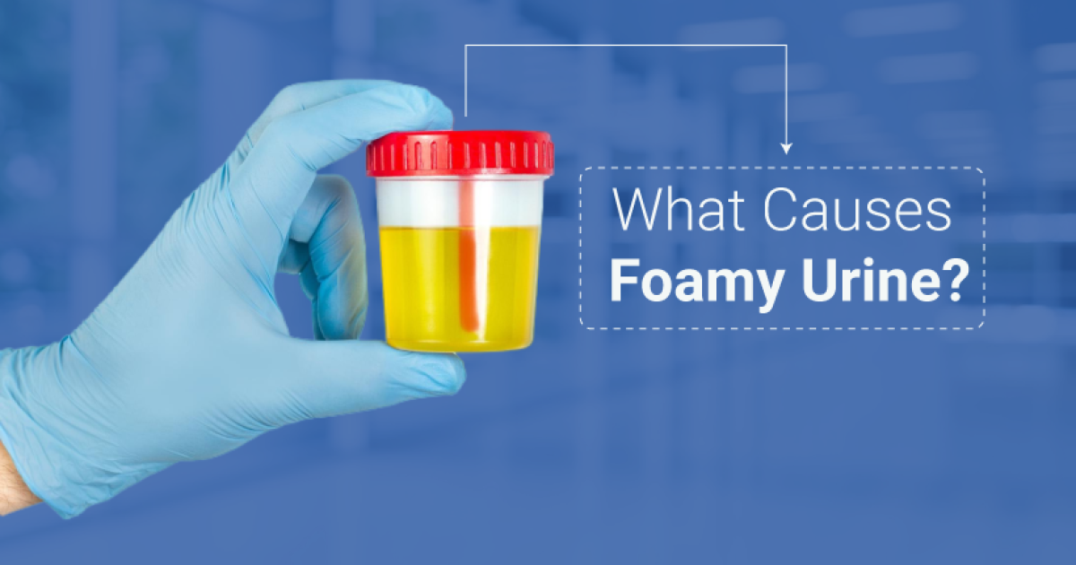 What Causes Foamy Urine
